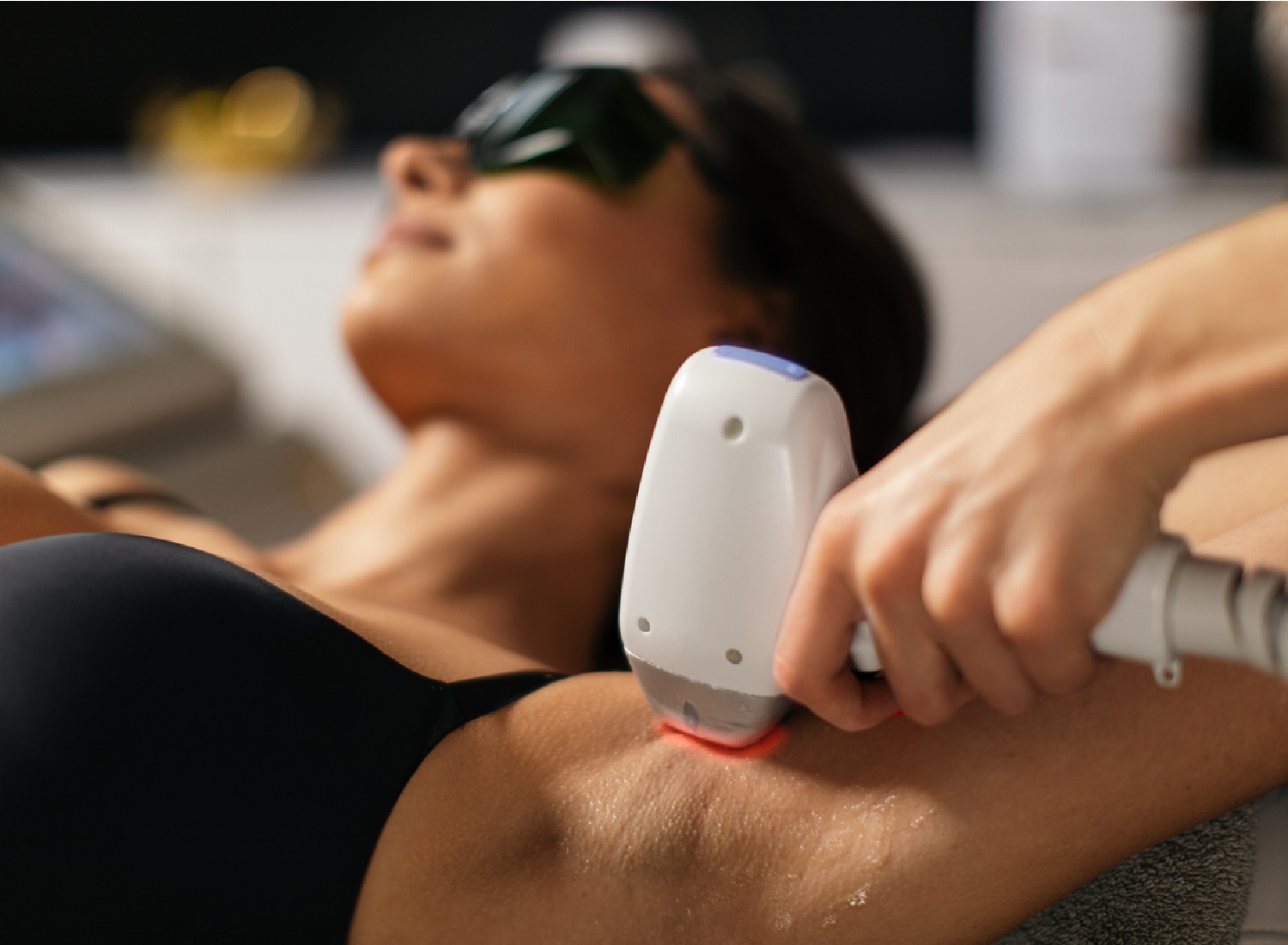 laser hair removal